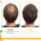 Biotin-Haarkugel für sanfte Pflege und glattes Haar 13