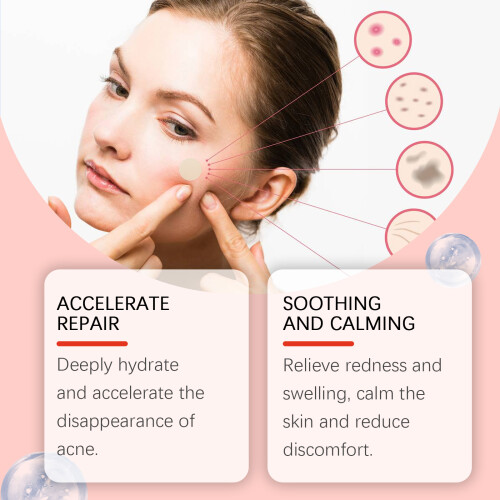 Invisible Acne Patch for Treatment & Removal 2