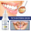 Teeth Whitening Serum, Remove Yellow Stains Deep Cleaning 3