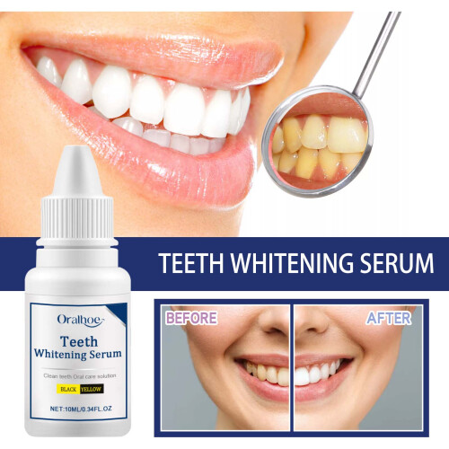 Teeth Whitening Serum, Remove Yellow Stains Deep Cleaning 2