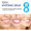 Teeth Whitening Serum, Remove Yellow Stains Deep Cleaning 11