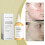 Acne Control Moisturizing Toner Gentle Hydrating 8