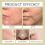 Acne Control Moisturizing Toner Gentle Hydrating 15