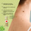 Wart & Corns Care Patch 14