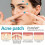 Hydrocolloidal Acne Patch Invisible Breathable Waterproof Repair 10