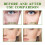 Antifalten-Serum Flecken & feine Linien straffend 15