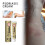 Psoriasis-Creme gegen rote, juckende Haut 2