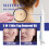 Double Head Wart & Mole Removal Pen Set 13