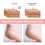Anti-Crack Hand & Foot Moisturizer 4