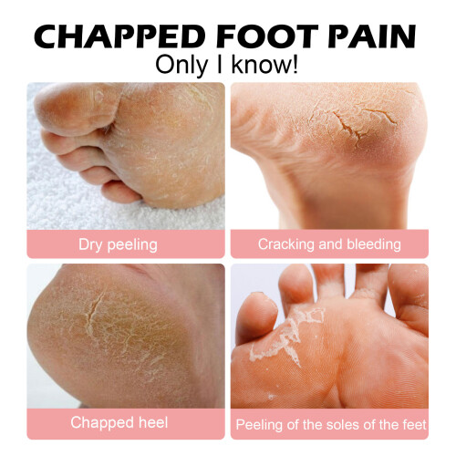 Anti-Crack Hand & Foot Moisturizer 2