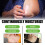 Psoriasis Cream, Relieves Itchy Skin & Redness 3