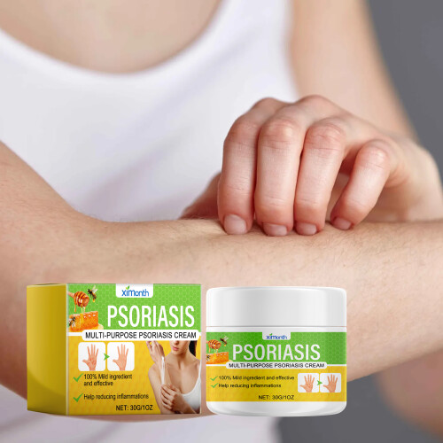 Psoriasis Cream, Relieves Itchy Skin & Redness 1