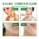 Aloe Vera Scrub for Deep Cleansing, Exfoliating, Smoothing Acne Marks 11