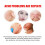 Cloud Acne Patch, Invisible Blemish Repair Acne Muscle Reduce Marks 14
