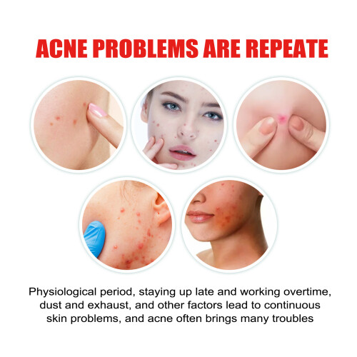 Cloud Acne Patch, Invisible Blemish Repair Acne Muscle Reduce Marks 2