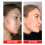 Cloud Acne Patch, Invisible Blemish Repair Acne Muscle Reduce Marks 15