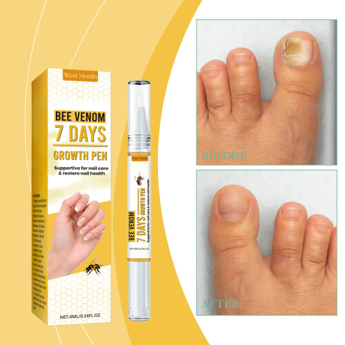 Nail Repair Solution Hand Foot Gentle Moisturizing 1