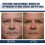 Peptid-Lifting-Augengel gegen stumpfe Haut & Anti-Aging 14