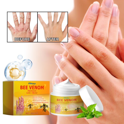Bee Venom Psoriasis Cream for Hands & Feet Relief 1
