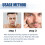 Peptid-Lifting-Augengel gegen stumpfe Haut & Anti-Aging 10