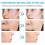 Acne Gel for Closed Pimples, Lighten Marks, Blackheads 15