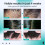 Scalp Massager Roller for Itchy Scalp Relief, Moisturizing 15
