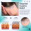 Scalp Massager Roller for Itchy Scalp Relief, Moisturizing 4