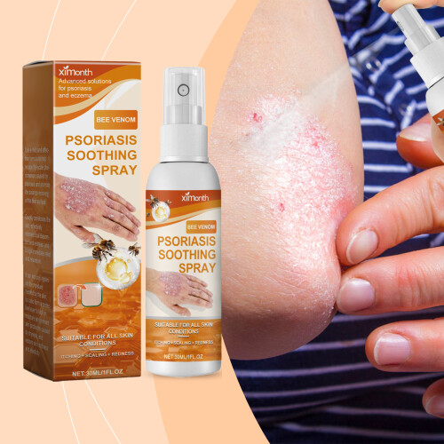 Hautspray gegen Juckreiz, feuchtigkeitsspendend 1