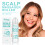 Scalp Massager Roller for Itchy Scalp Relief, Moisturizing 2