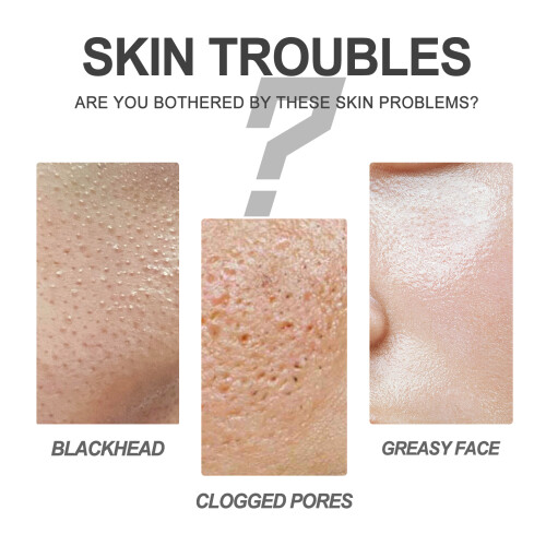 Pore Minimizing Kit: Cleansing Blackhead Remover & Moisturizing 2