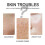 Pore Minimizing Kit: Cleansing Blackhead Remover & Moisturizing 12