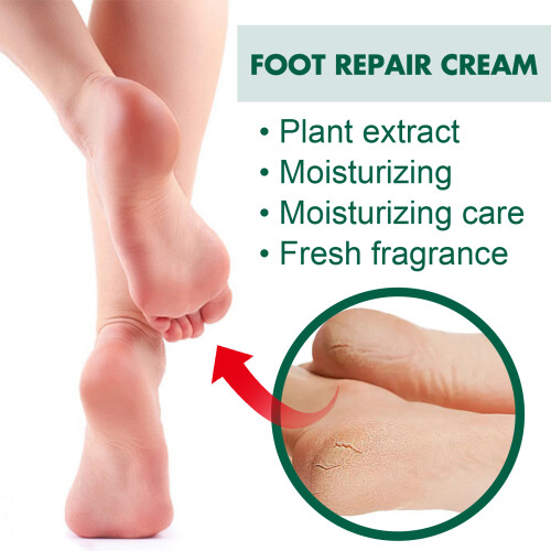 Foot Repair Cream Heel Cracks Dry Itchy Skin Moisturizing 2