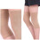 Knie-Kompressionsmanschette, Chemiefaser, 13