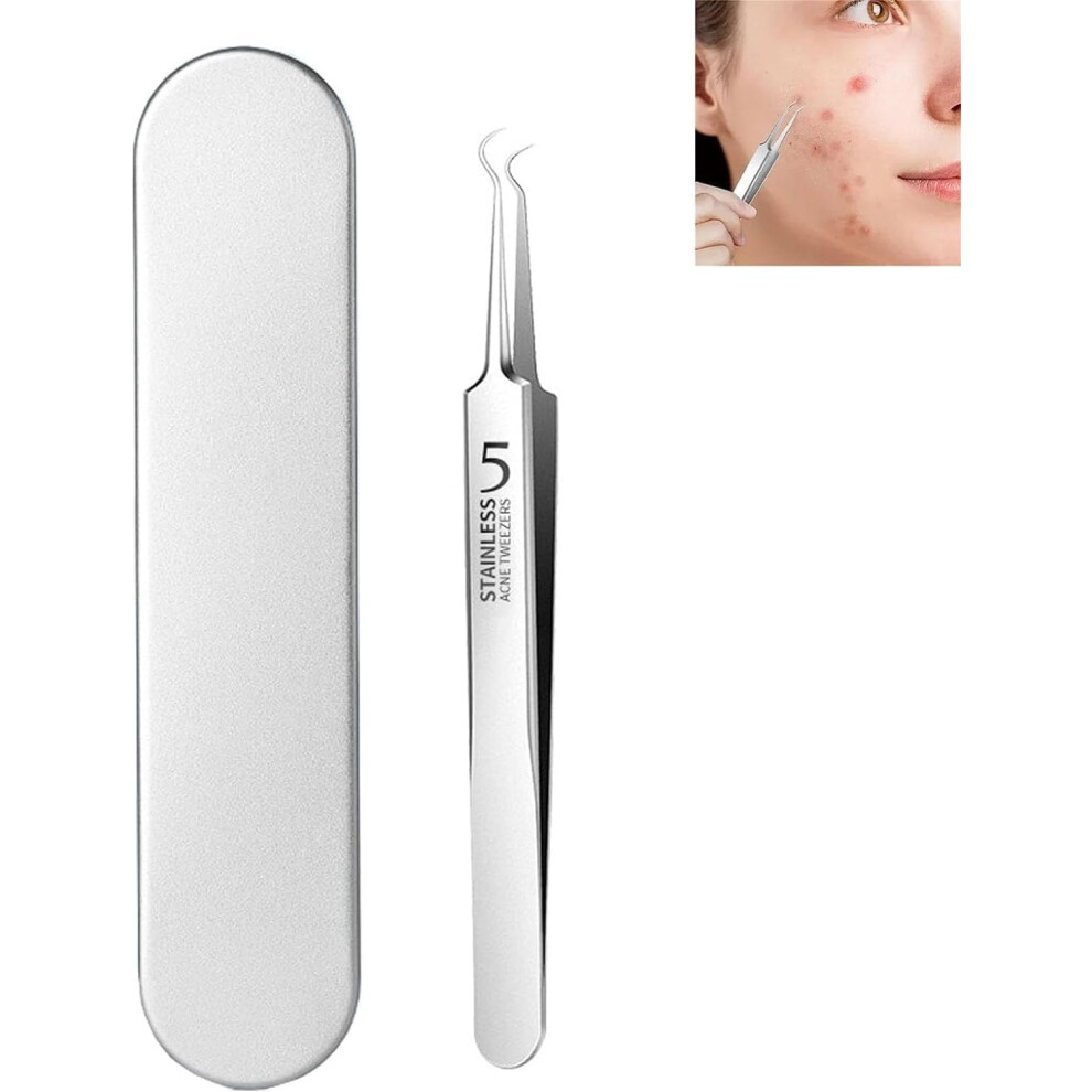 Tweezers for blackheads, facial blackhead remover, 3in1, stainless steel tools