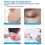 Patches for Wrinkles, Cesarean Section Patches 3