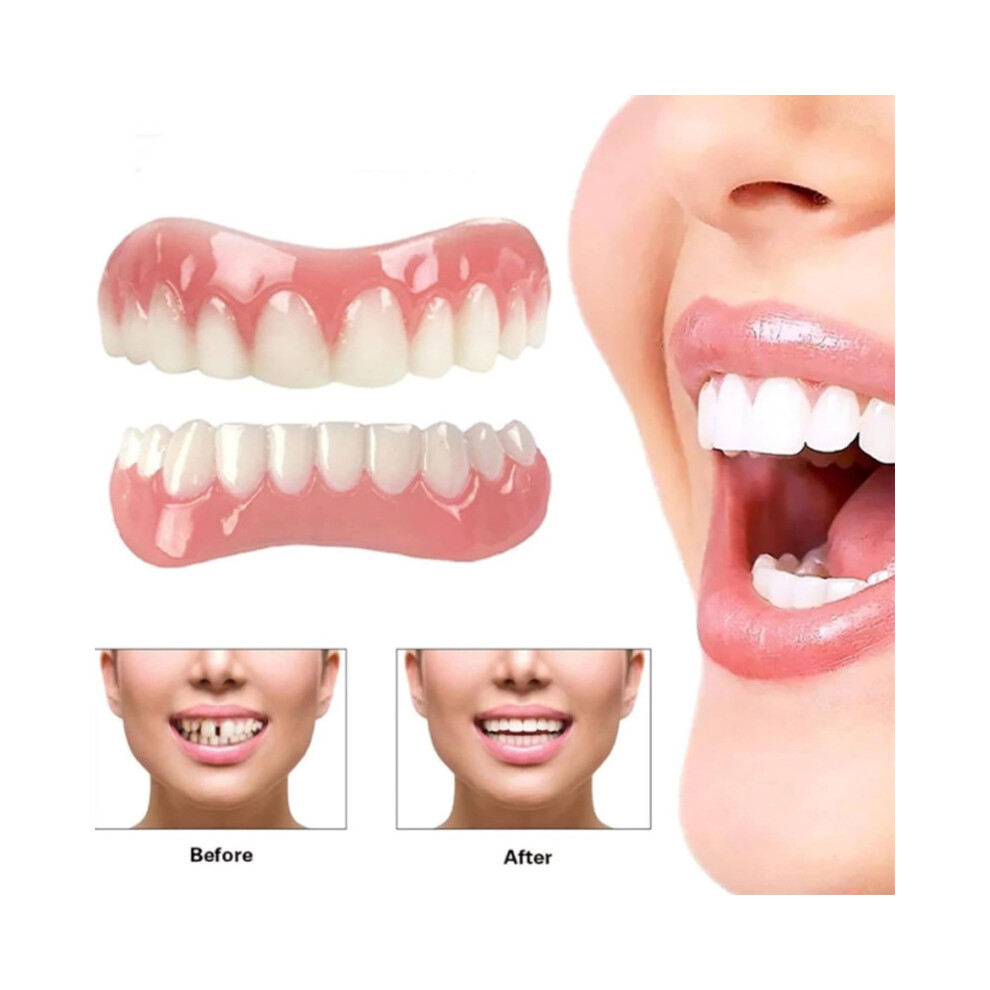 2 Sets Of Dentures, Upper And Lower Jaw Dentures, Natural And Comfortable, Protect The Teeth, And Regain A Confident Smile