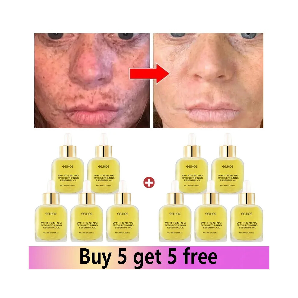 Dark (10 Pcs) Vitamin C Whitening Freckles Serum Remove Spots Freckles Fade Melanin Nicotinamide Essence Brighten Moisturizing