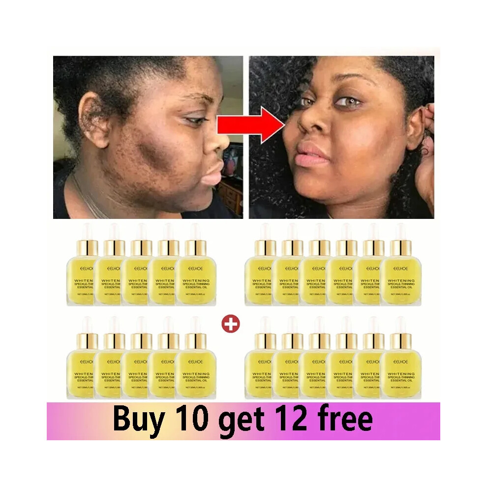 Dark (22 Pcs) Vitamin C Whitening Freckles Serum Remove Spots Freckles Fade Melanin Nicotinamide Essence Brighten Moisturizing