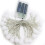 LED Starry Light Battery Powered Globe String Lights, Fairy Light with Remote Control Timer Function IP65 Waterproof Adjustable Lighting Modes Festive 2