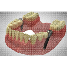 500 Piece Rendering Implantat Dentals Pictures Jigsaw Puzzle Set - Difficult for Adults Children Educational