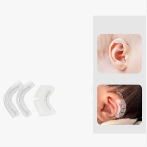 Protruding Ear Support Infant Corrector Auricle Correction Patch Baby 2