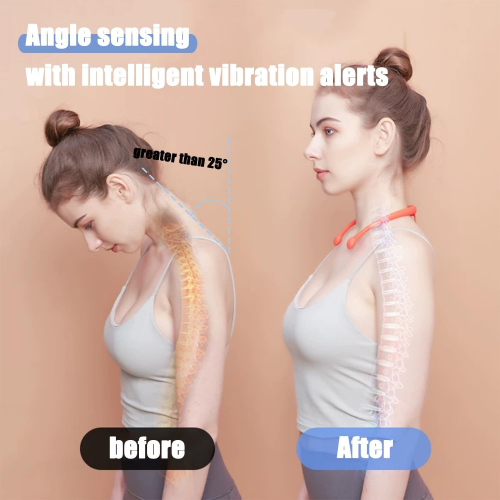 Smart Posture Corrector Device, Posture Reminder Improving The Hunchback Posture Trainer, Used For Body Correction 1