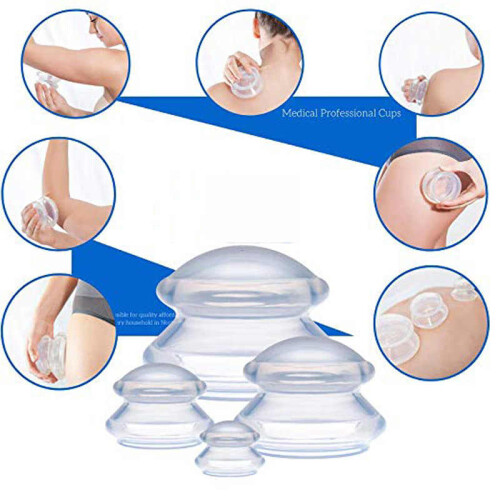Cupping for full body massage 4-pack (L-XS) White 1