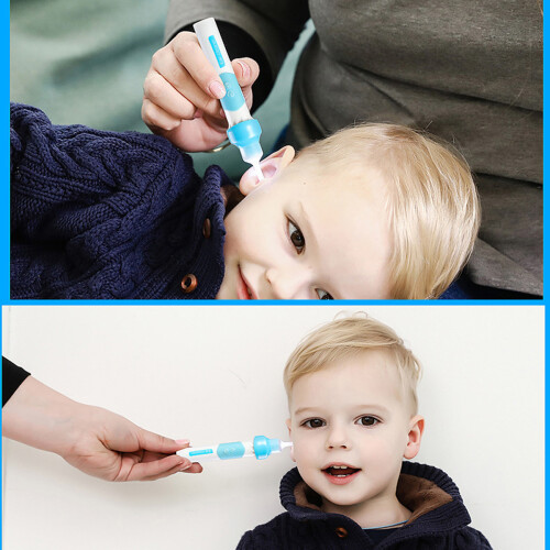 Ear Canal Guardian, Αφαίρεση Κεριού Αυτιών με Σκούπα και Φως LED, Εξασφαλίζει Ασφαλή και