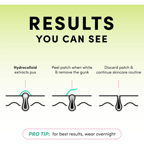 Dots for Spots Pimple Patches 1