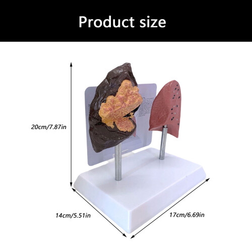 Vergelijkend rokerlong versus gezond longmodel voor 2