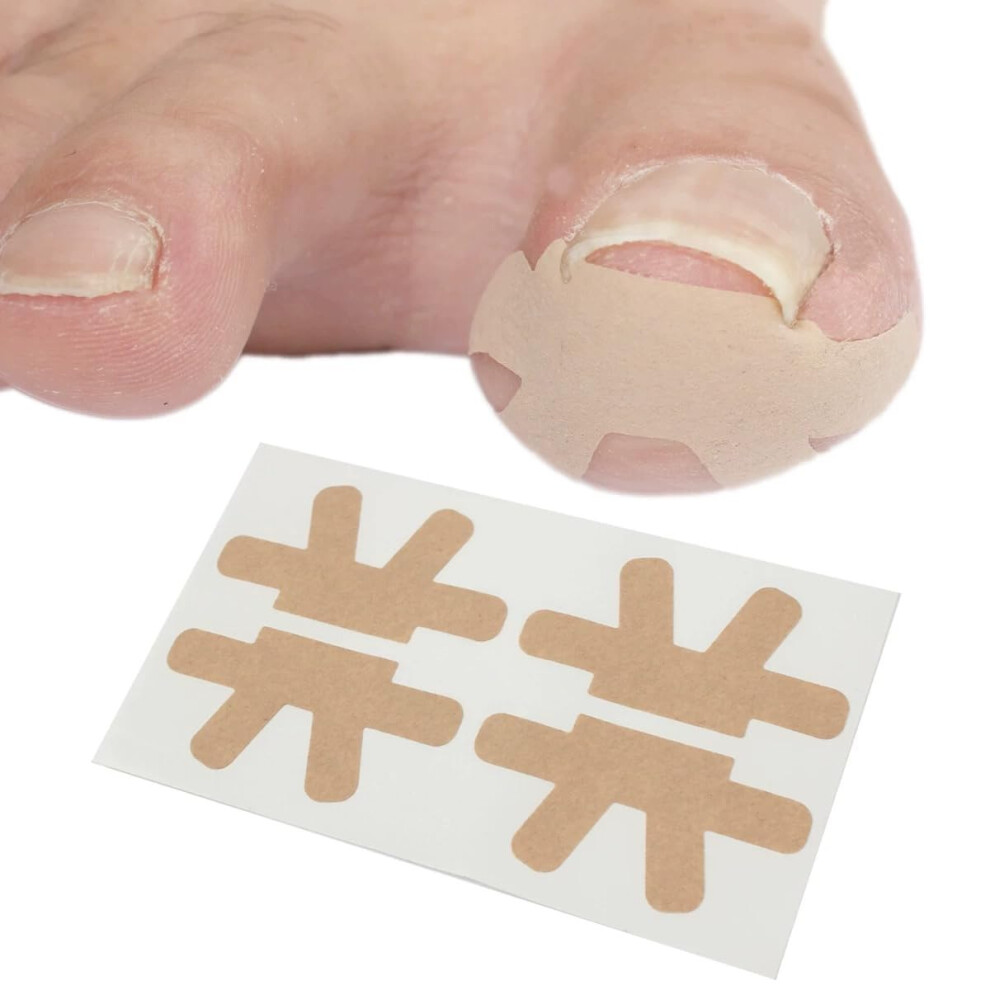 Ingrown Toenail Treatment Strips 20Pcs for Pain Relief and Breathable Correction, Shape B