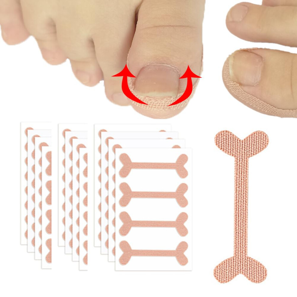 Ingrown Toenail Treatment 50pcs Breathable Glue Correction Patches for Foot Care