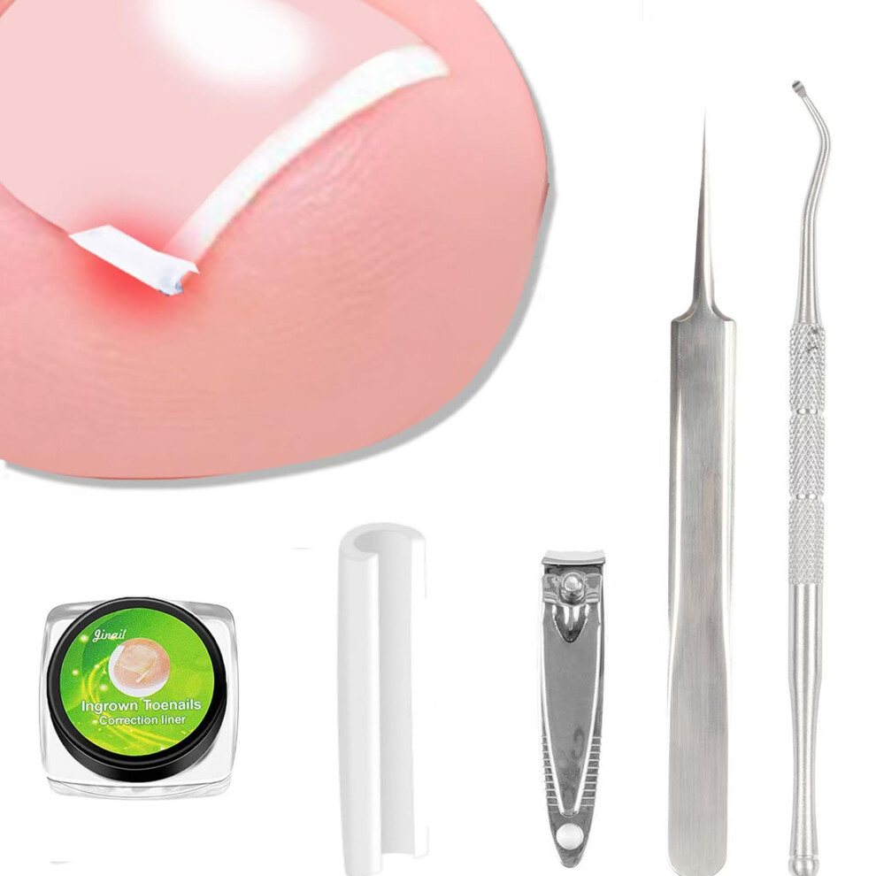 Ingrown Toenail Treatment Kit with 40 Pain Straightener Strips and Lifter Tools for Home Use