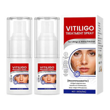 Vitiligo Treatment Spray with Botanical Extracts for Pigmentation Balance and Even Skin Tone (2)